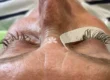 Beschädigte Wimpern nach Wimpernverlängerung