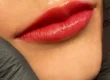 Lippenpigmentierung nach der Behandlung