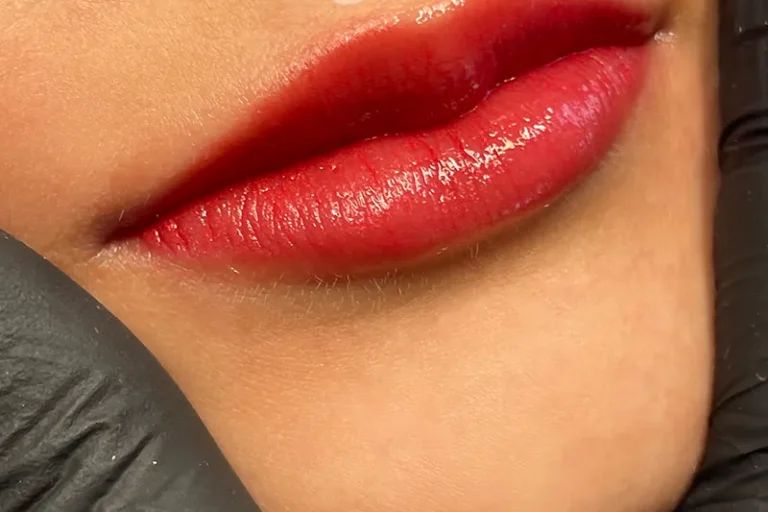 Lippenpigmentierung nach der Behandlung