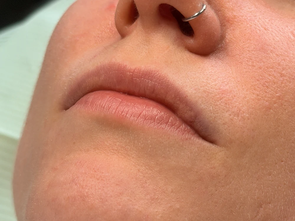 Lippenpigmentierung im Greenlotus Spa (vor der Behandlung)